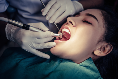 Root Canal Treatment
